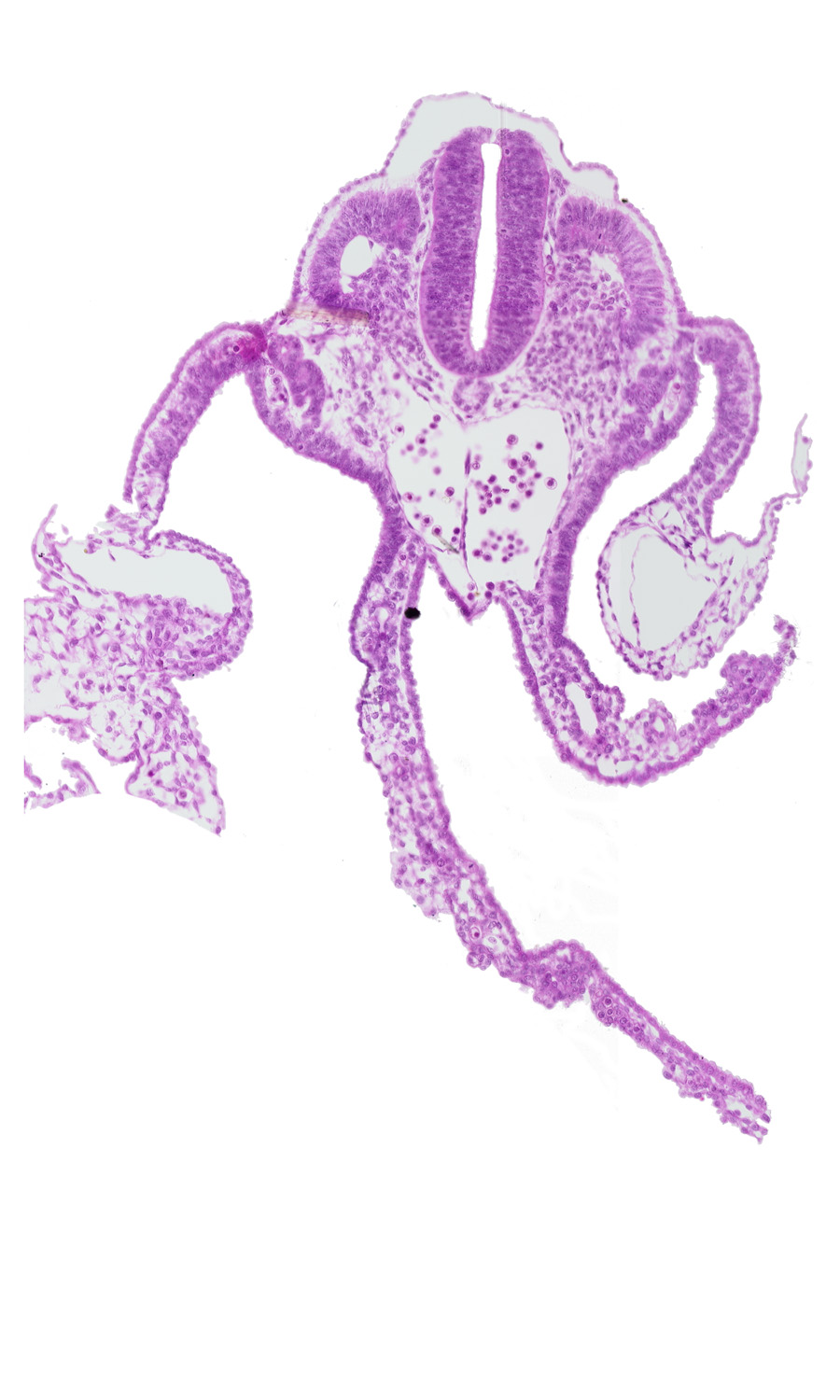 dermatomyotome 11 (C-7), dorsal aorta, left umbilical vein, midgut, origin of vitelline (omphalomesenteric) artery, presumptive upper limb bud, sclerotome, surface ectoderm, umbilical vesicle wall