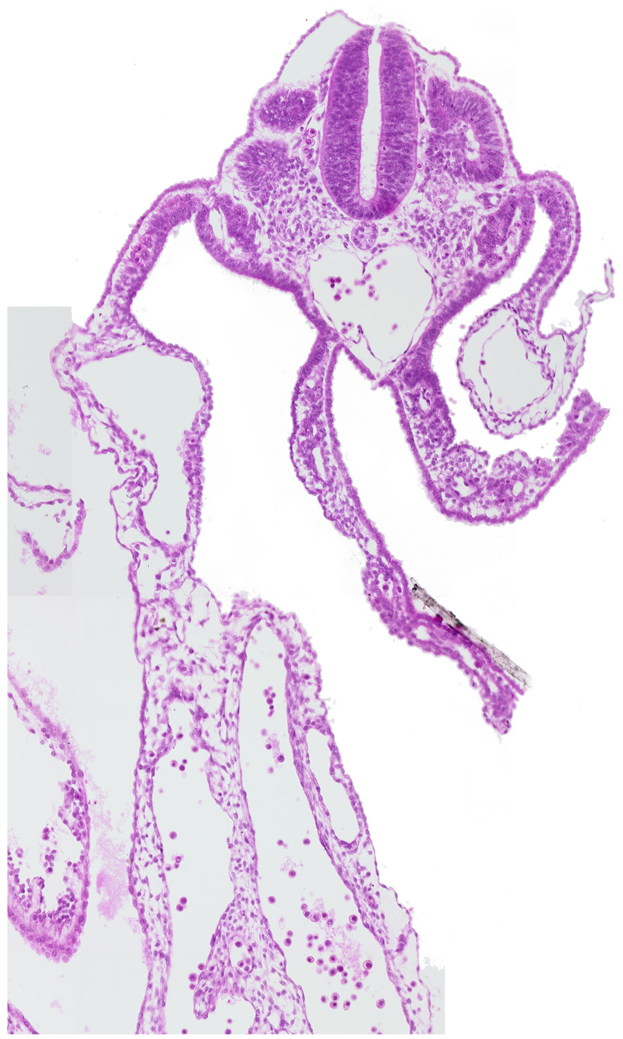 aorta, common umbilical artery, dermatomyotome 11 (C-7), left umbilical vein, right umbilical vein