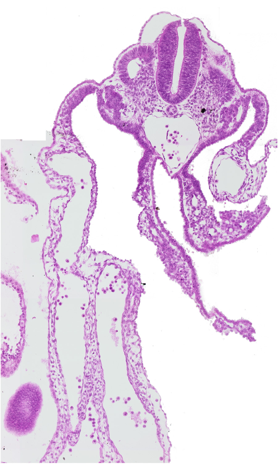 aorta, caudal edge of caudal eminence, caudal edge of dermatomyotome 11 (C-7), caudal edge of midgut, cephalic edge of dermatomyotome 12 (C-8), common umbilical artery, dermatomyotome 11-12 intersegmental region, right umbilical vein