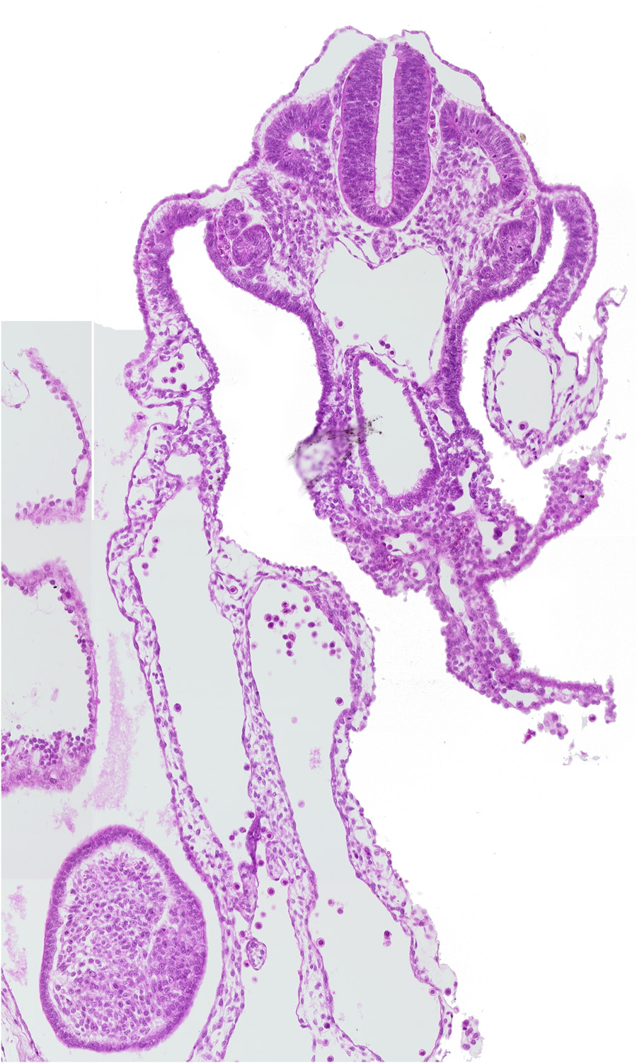 amniotic cavity, aorta, caudal eminence, caudal intestinal portal, dermatomyotome 12 (C-8), mesonephric vesicle(s)