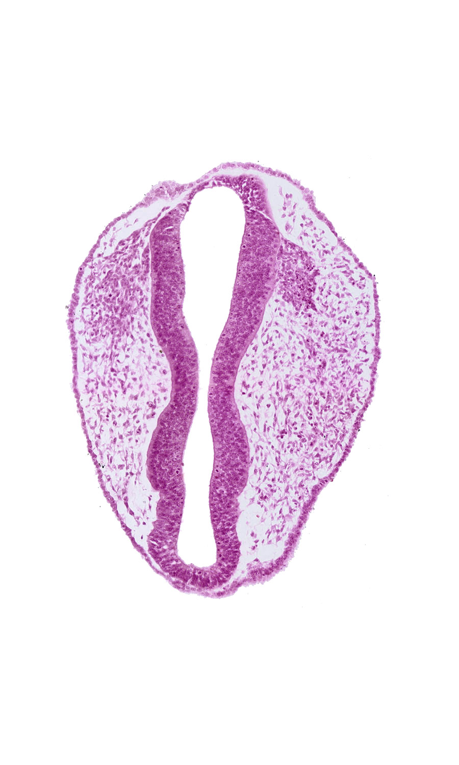 head mesenchyme, mesencephalon (M1), mesencephalon (M2), mesencoel, rhombencephalon (Rh. 1), rhombencephalon (Rh. 2), rhombencoel (fourth ventricle), trigeminal neural crest (CN V)