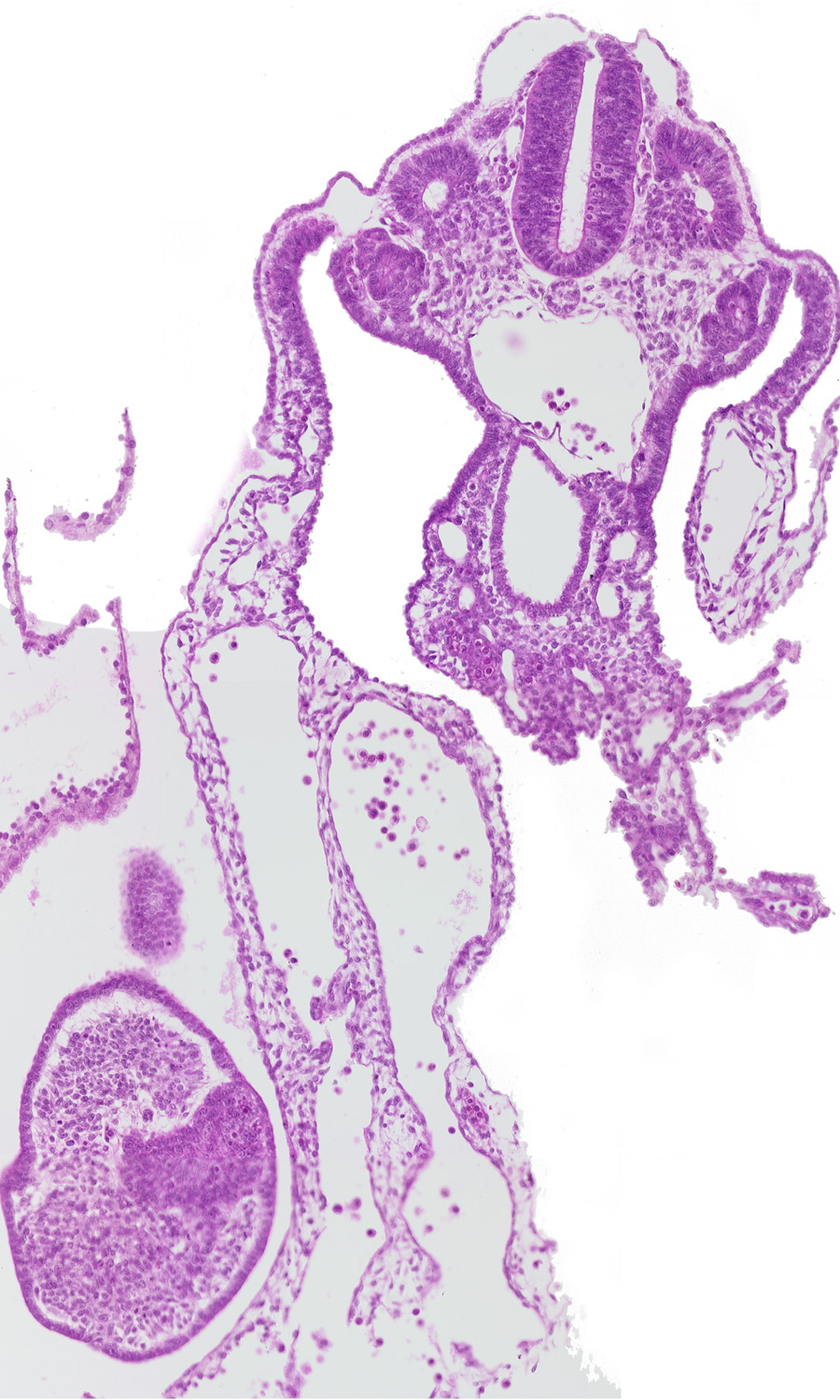amniotic cavity, aorta, caudal wall of cloaca, common umbilical artery, dermatomyotome 12 (C-8), hindgut, hindgut arterial plexus, separation artifact