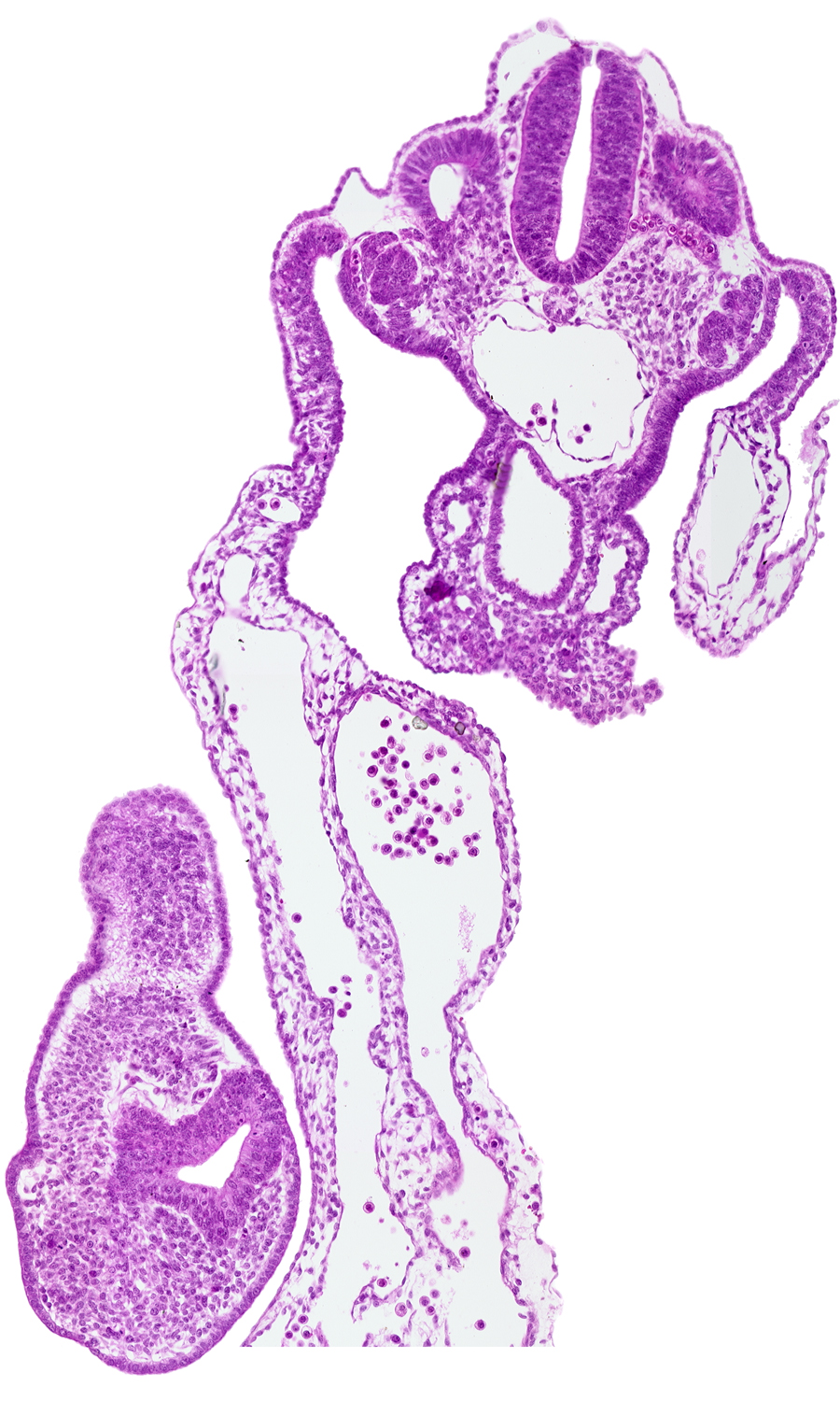 amnion attachment, aorta, caudal edge of cloacal lumen, caudal eminence, cloacal membrane, communication between peritoneal cavity and extra-embryonic coelomic cavity, dermatomyotome 12 (C-8), mesonephric duct, mesonephric vesicle(s)