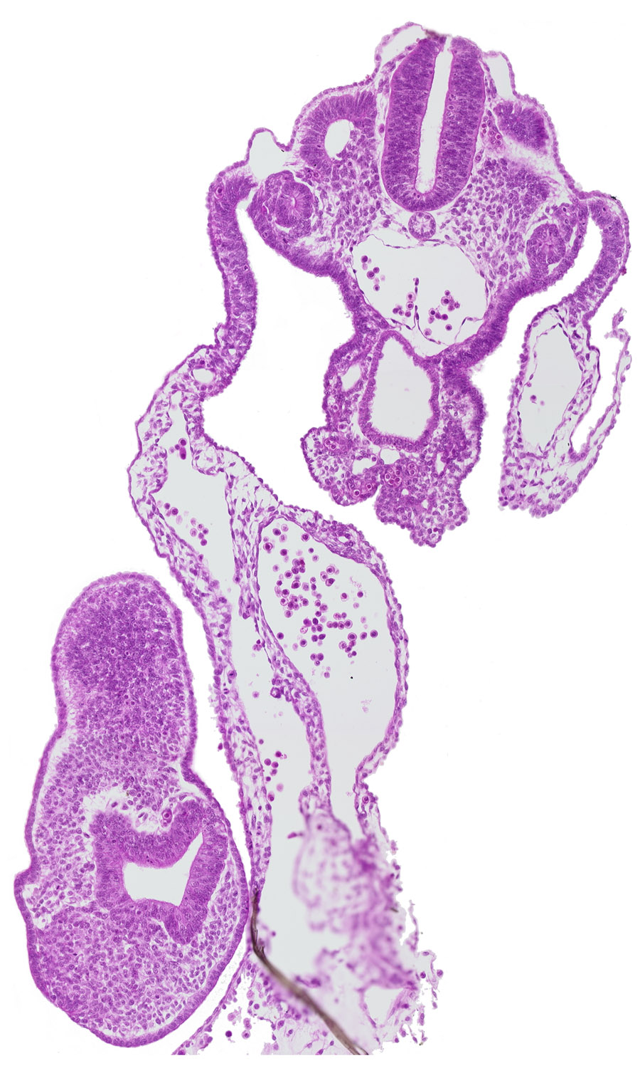 aorta, caudal edge of dermatomyotome 12 (C-8), caudal eminence, cloacal membrane, common umbilical artery, gastrulation (primitive) streak, mesonephric vesicle(s), presumptive upper limb bud, separation artifact