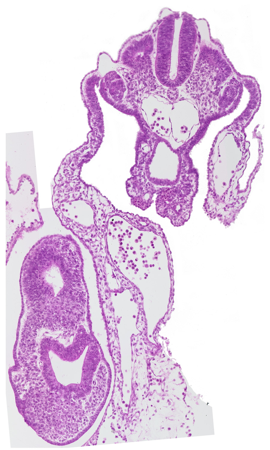 amnion attachment, caudal edge of peritoneal cavity, caudal eminence, caudal part of upper limb bud, cephalic edge of dermatomyotome 13 (T-1), cloacal membrane, gastrulation (primitive) streak, mesonephric vesicle(s), neural plate