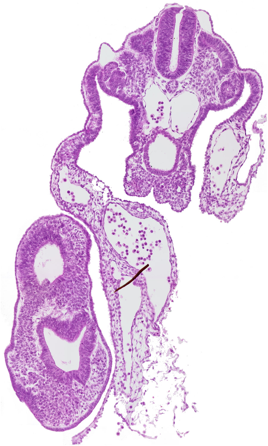 amnion, amnion attachment, caudal eminence, caudal part of peritoneal cavity, cloaca, cloacal membrane, common umbilical artery, dermatomyotome 13 (T-1), gastrulation (primitive) streak, hindgut, left umbilical vein, mesonephric vesicle(s), neural plate, right umbilical vein