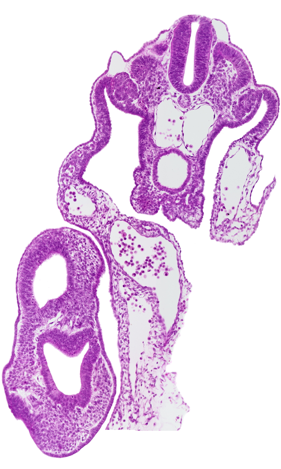 common umbilical artery, dermatomyotome 13 (T-1), gastrulation (primitive) streak, left umbilical vein, mesonephric vesicle(s), neural plate, origin of vitelline (omphalomesenteric) artery, peritoneal cavity, presumptive upper limb bud, primordial genital ridge, right umbilical vein, surface ectoderm