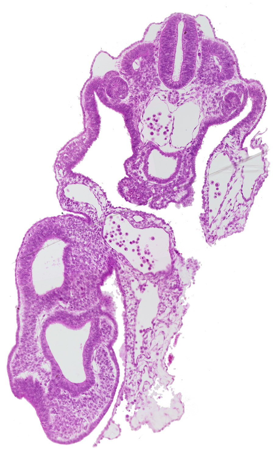 allantois, caudal edge of notochord, common umbilical artery, dermatomyotome 13 (T-1), dorsal aorta, gastrulation (primitive) streak, left umbilical vein, mesoderm, mesonephric vesicle(s), peritoneal cavity, primordial genital ridge, right umbilical vein, sclerotome, somitocoel