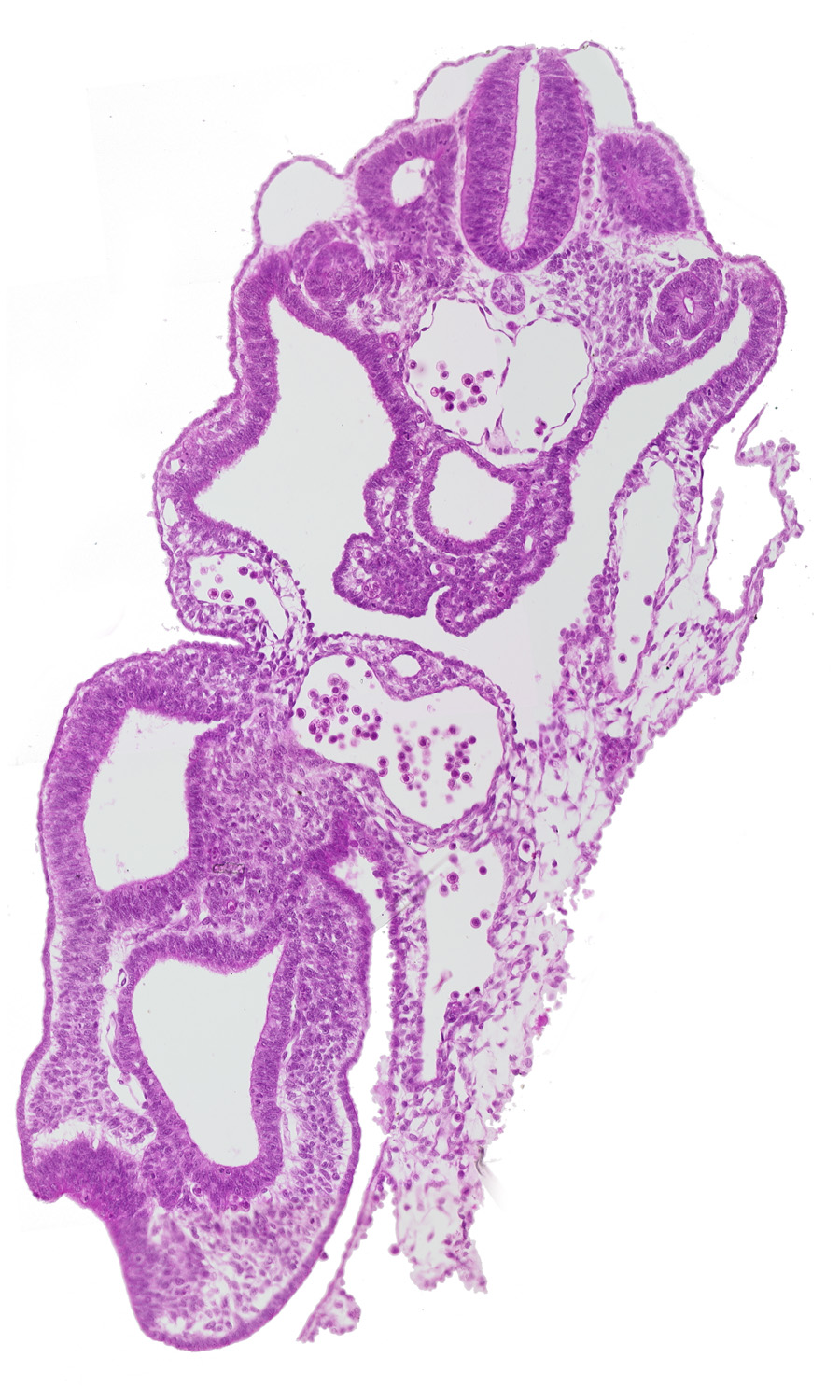 allantois, caudal part of notochord, cloaca, common umbilical artery, dermatomyotome 13 (T-1), hindgut, left umbilical vein, perinotochordal lamina, peritoneal cavity, primordial genital ridge, somatopleuric mesoderm, splanchnopleuric mesoderm