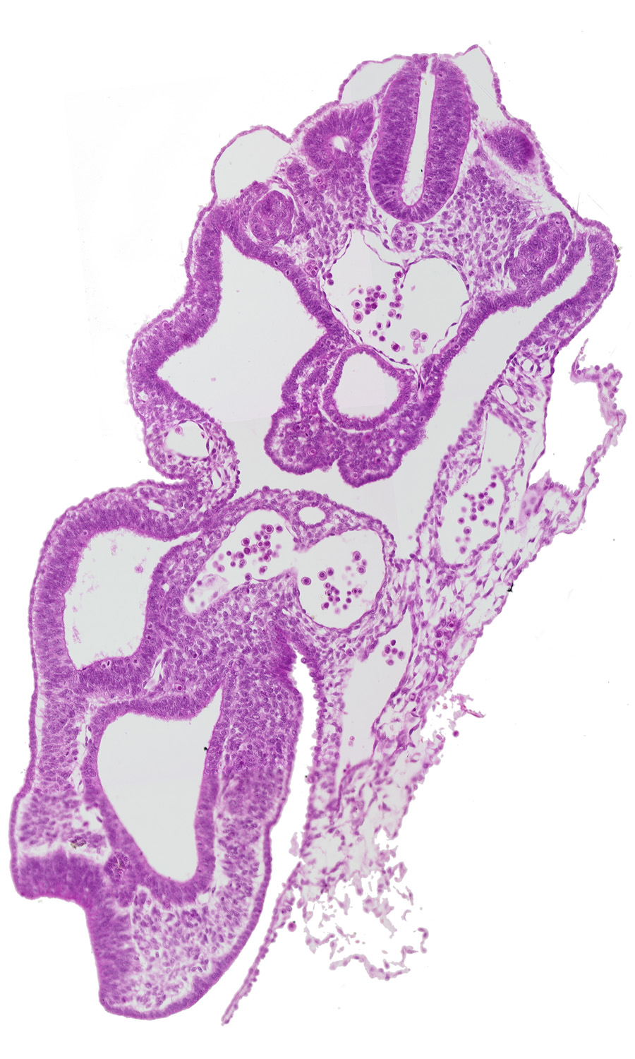 allantois, aorta, artifact separation(s), caudal edge of dermatomyotome 13 (T-1), caudal edge of presumptive upper limb bud, cloaca, hindgut, junction of umbilical arteries, mesonephric duct, peritoneal cavity