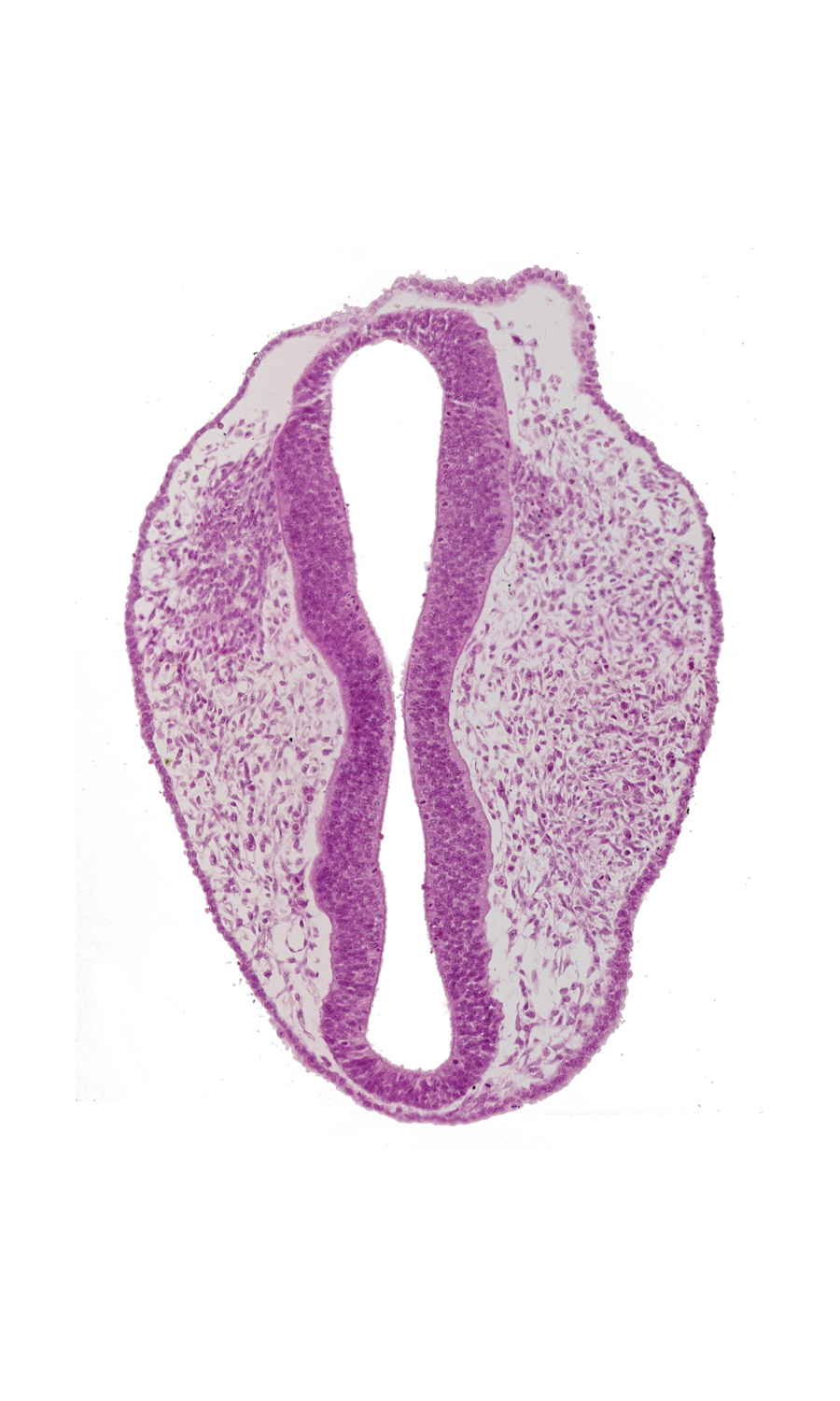 caudal edge of trigeminal neural crest (CN V), diencephalon (D2), mesencephalon (M1), mesencephalon (M2), mesencoel, prosencoel (third ventricle), rhombencephalon (Rh. 1), rhombencephalon (Rh. 2), rhombencoel (fourth ventricle), roof plate