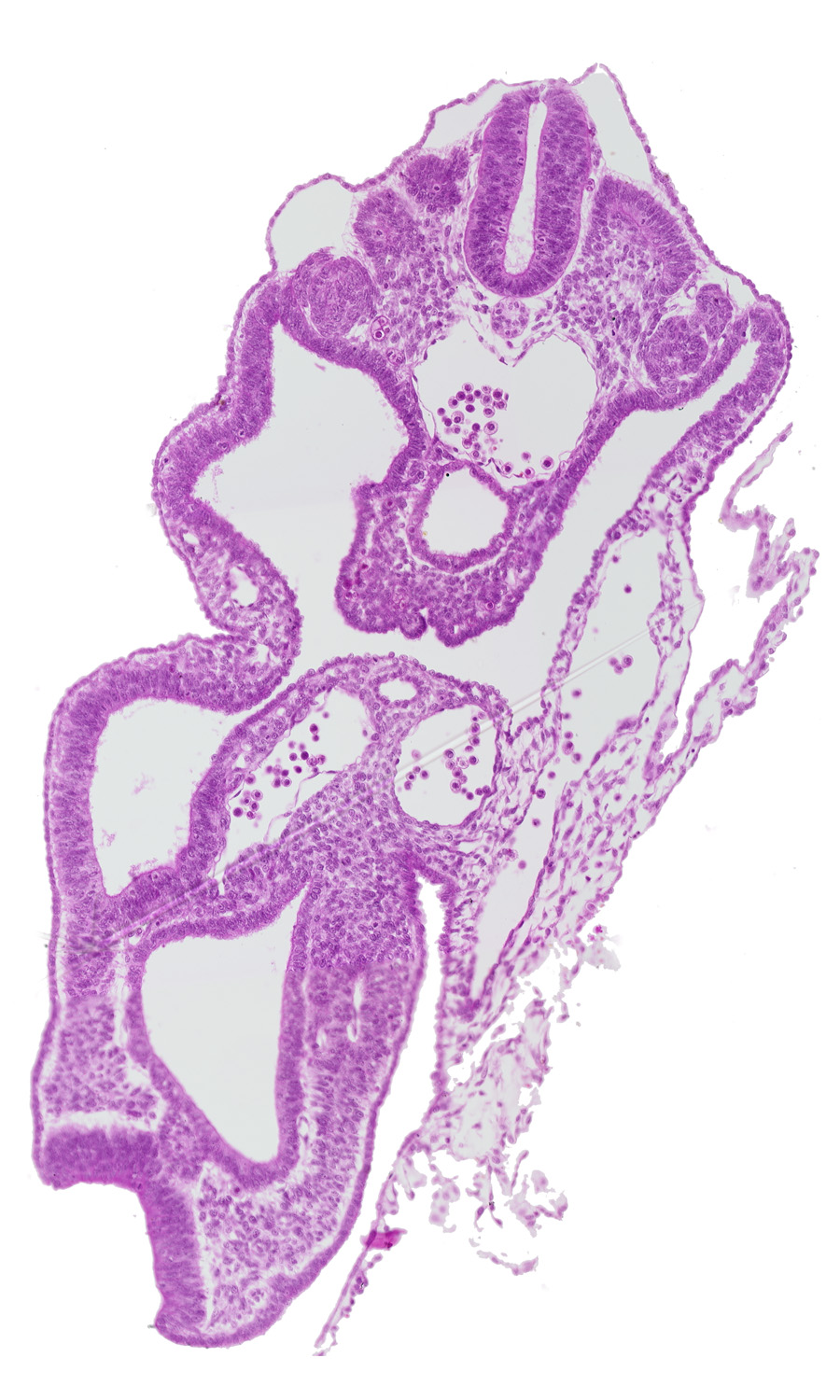 allantois, aorta, cephalic edge of dermatomyotome 14 (T-2), cloaca, hindgut, junction of left umbilical vein, left umbilical artery, mesonephric duct, mesonephric vesicle(s), notochord, peritoneal cavity, right umbilical artery