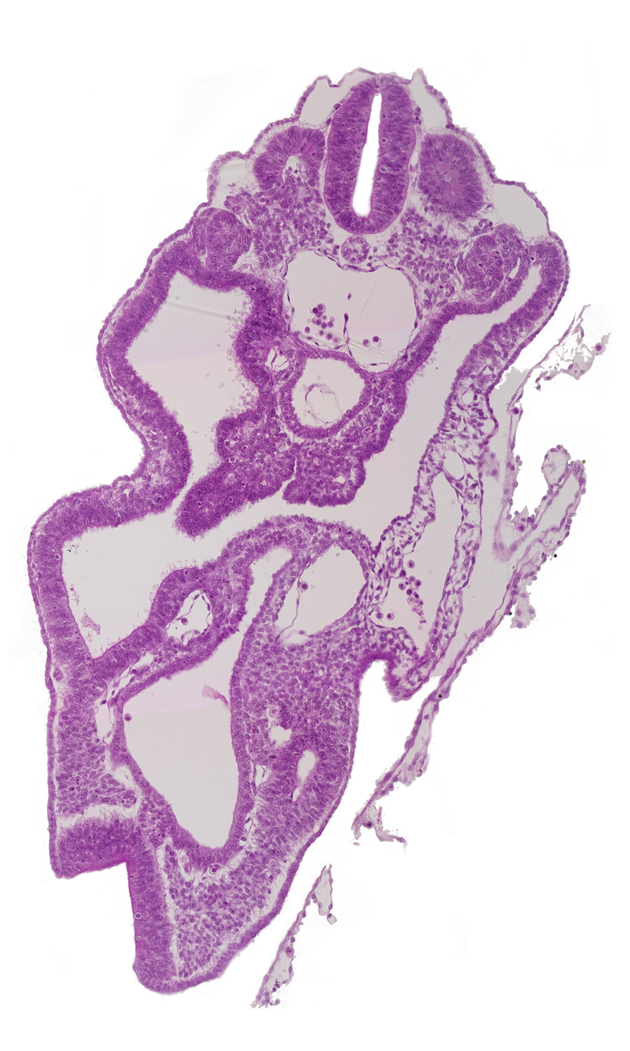 aorta, cloaca, dermatomyotome 14 (T-2), hindgut, junction of allantois and cloaca, left umbilical artery, mesonephric duct, right umbilical artery