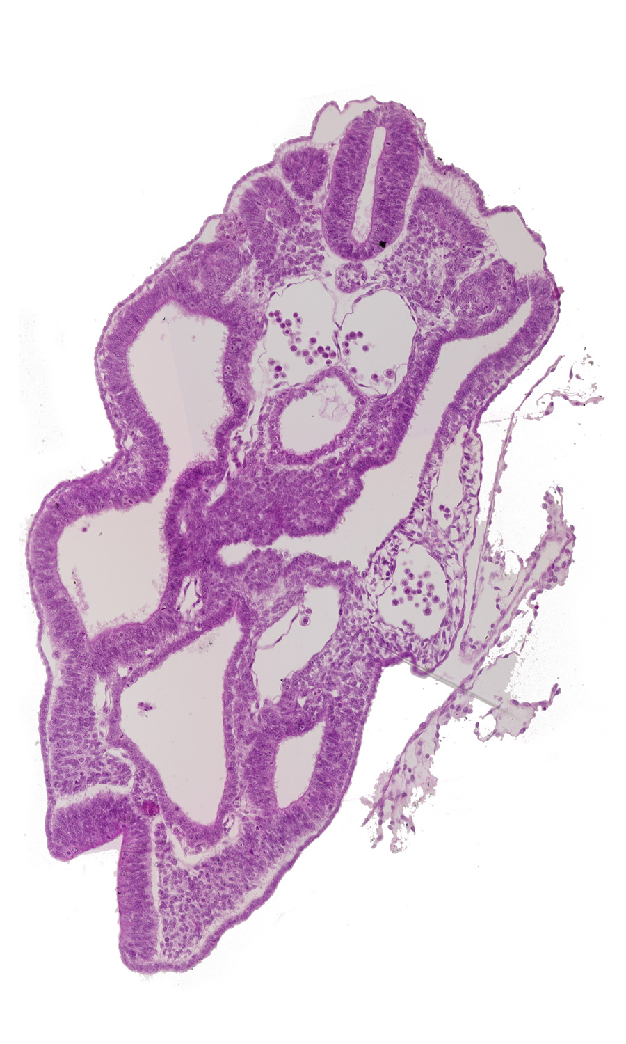 cloaca, dermatomyotome 15 (T-3), hindgut, left umbilical artery, left umbilical vein, mesonephric duct, peritoneal cavity