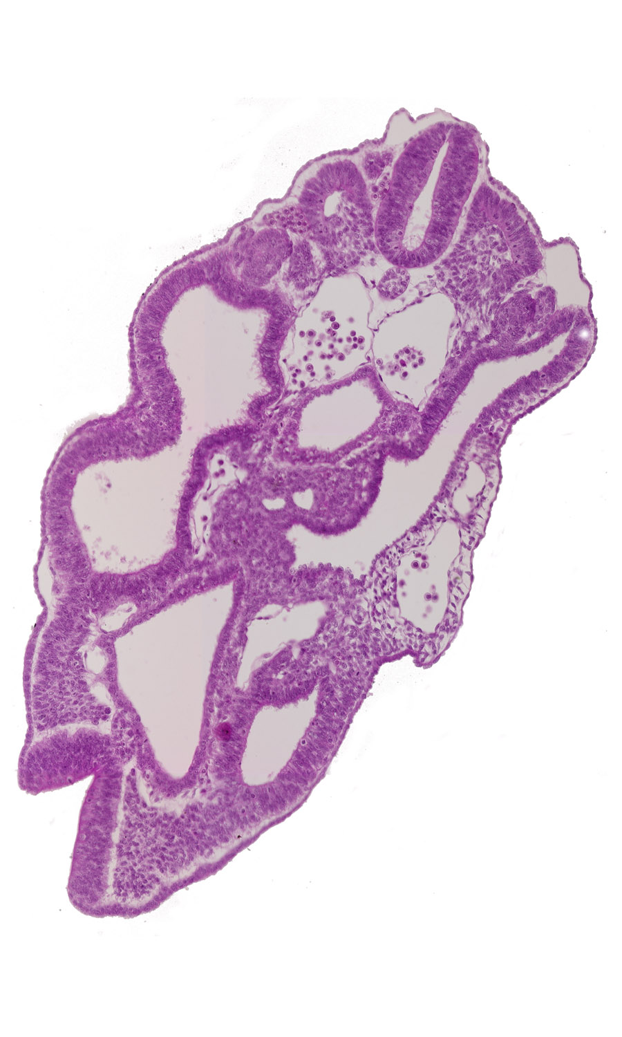 caudal neuropore, cloaca, dermatomyotome 15 (T-3), junction of cloaca and mesonephric duct, left common iliac artery, left umbilical artery, left umbilical vein, mesonephric vesicle(s), neural fold, perinotochordal lamina, right common iliac artery