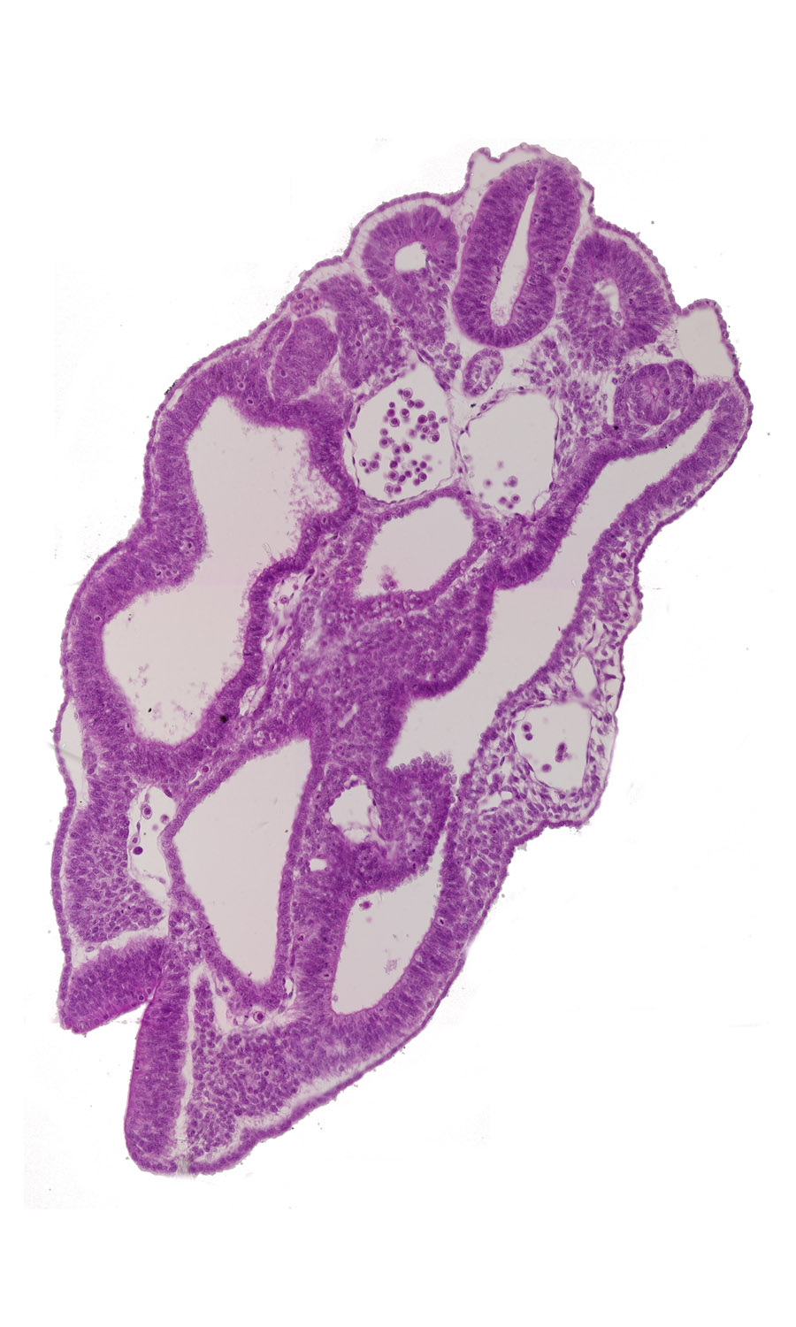 cloaca, dermatomyotome 15 (T-3), hindgut, left umbilical artery, left umbilical vein, mesonephric duct, notochord, paraxial mesoderm, peritoneal cavity, sclerotome