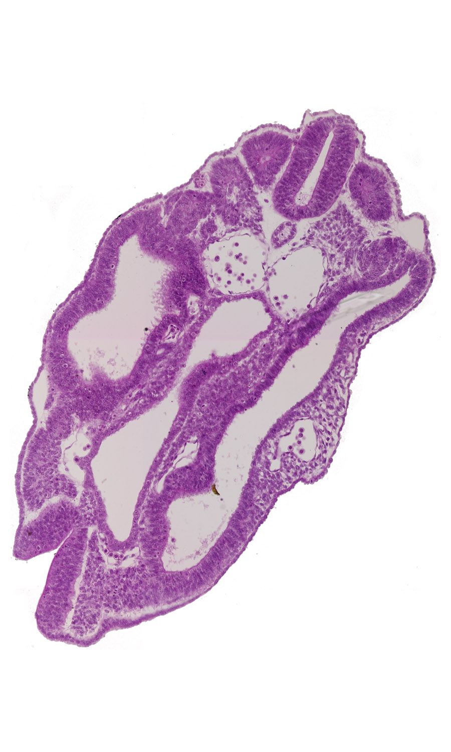 caudal neuropore, cephalic edge of dermatomyotome 16 (T-4), dermatomyotome 15 (T-3), dermatomyotome 15-16 intersegmental region, endoderm, junction of cloaca and hindgut, left common iliac artery, neural tube, notochord, peritoneal cavity, right common iliac artery, somatopleuric mesoderm, splanchnopleuric mesoderm, surface ectoderm, tributary of left umbilical vein