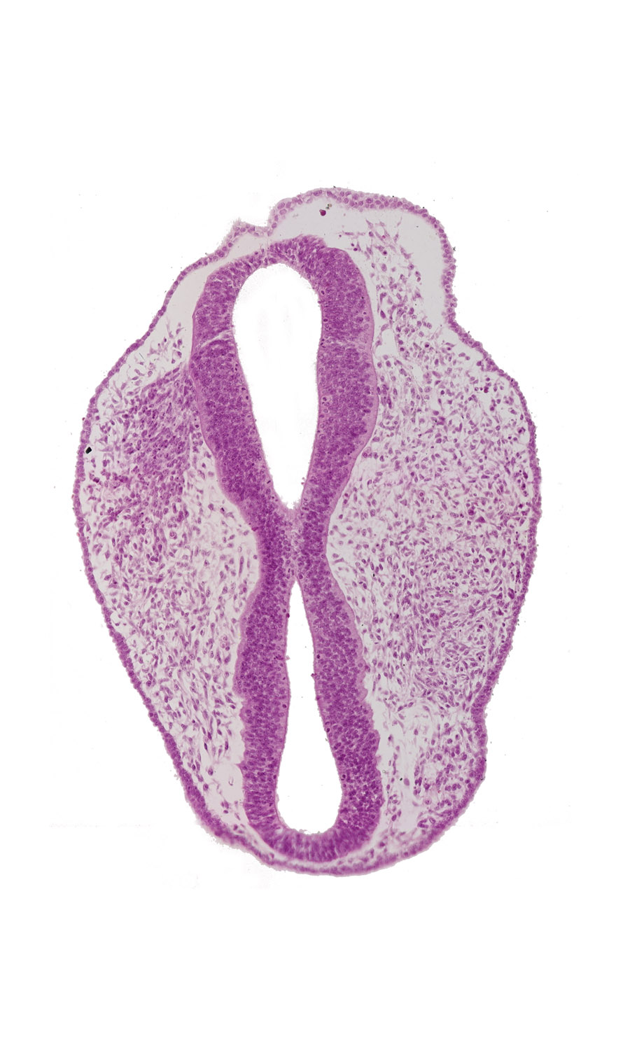 diencephalon (D2), head mesenchyme, mesencephalon (M1), mesencephalon (M2), mesencoel, prosencoel (third ventricle), rhombencephalon (Rh. 2), rhombencoel (fourth ventricle), roof plate, surface ectoderm, trigeminal neural crest (CN V)