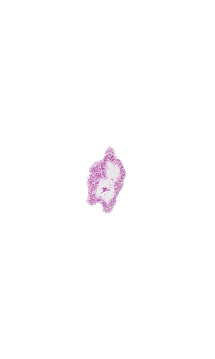 head mesenchyme, surface ectoderm at cephalic part of head, tangentially cut surface ectoderm