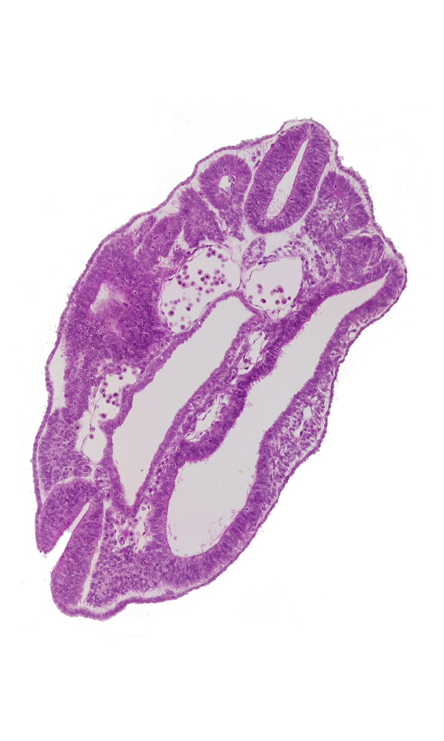 caudal edge of peritoneal cavity, cephalic edge of caudal neuropore, dermatomyotome 16 (T-4), hindgut, peritoneal cavity, sclerotome