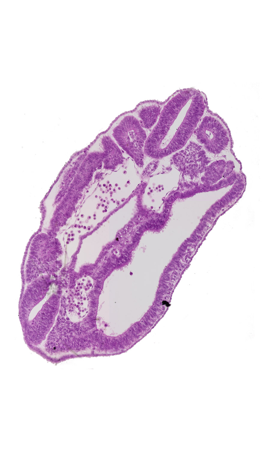 dermatomyotome 16 (T-4), hindgut, left common iliac artery, neural tube, peritoneal cavity, sclerotome, surface ectoderm