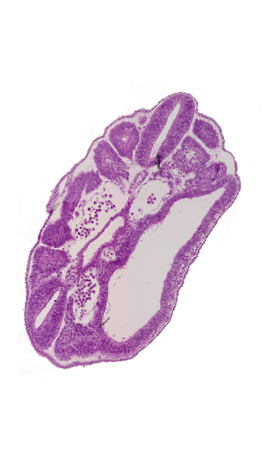 dermatomyotome 16 (T-4), hindgut, left common iliac artery, mesonephric duct, perinotochordal lamina, peritoneal cavity, right common iliac artery, somatopleure, somite 17 (T-5)