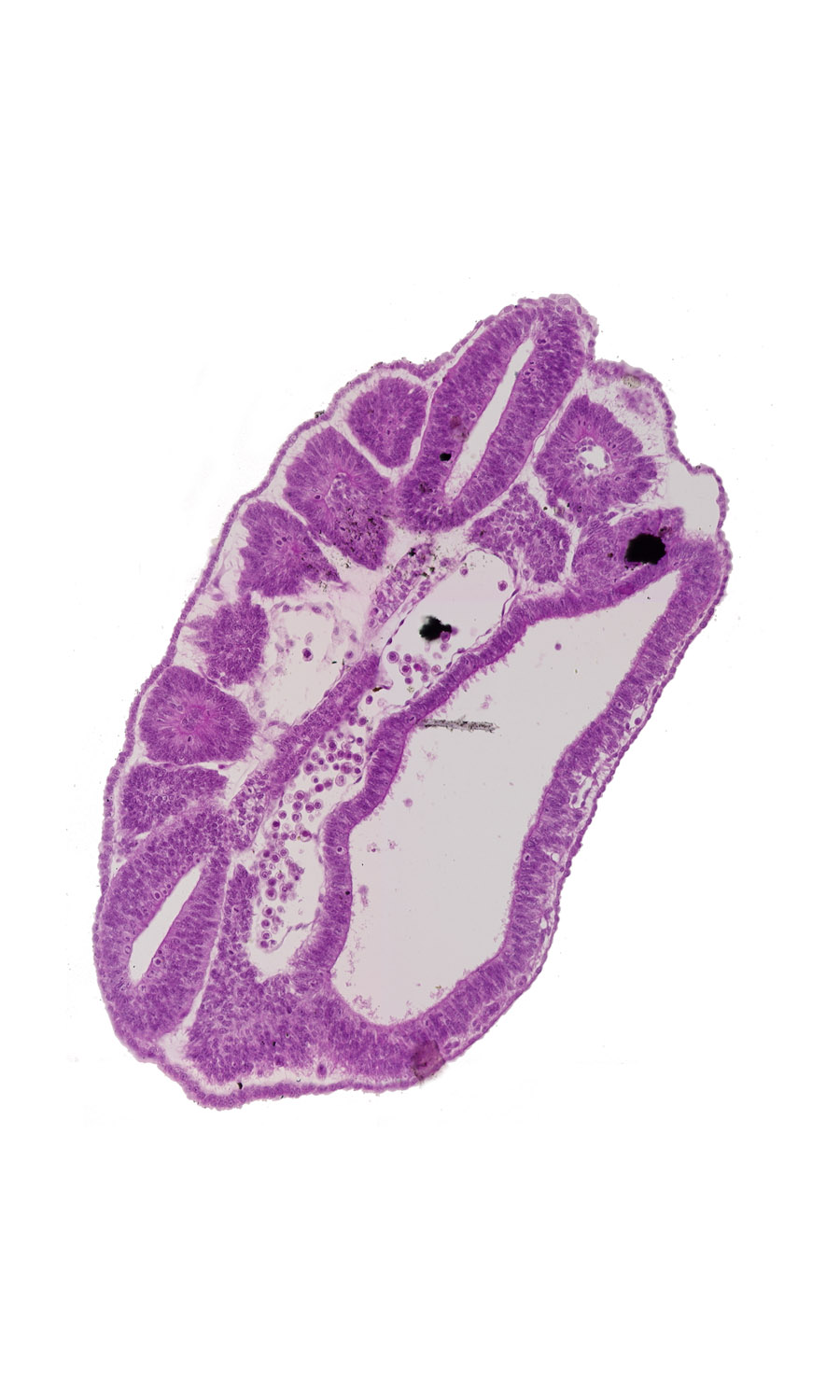 caudal edge of dermatomyotome 16 (T-4), dermatomyotome 16 - somite 17 intersegmental region, left common iliac artery, notochord, paraxial mesoderm, peritoneal cavity, right common iliac artery, somite 17 (T-5), somite 17-18 intersegmental space, somitocoel, ventral edge of somite 18 (T-6)