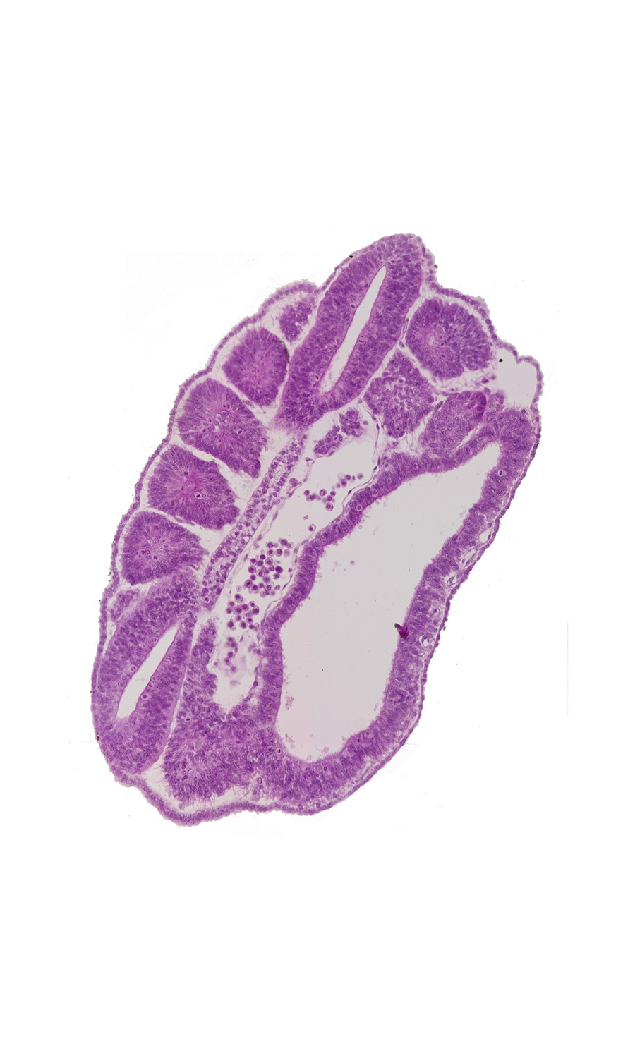 alar plate(s), basal plate, floor plate, intersegmental region, junction of aorta and left common iliac artery, neural tube, paraxial mesoderm, perinotochordal lamina, peritoneal cavity, roof plate, somatopleure, somite 17 (T-5), splanchnopleuric mesoderm, sulcus limitans, surface ectoderm