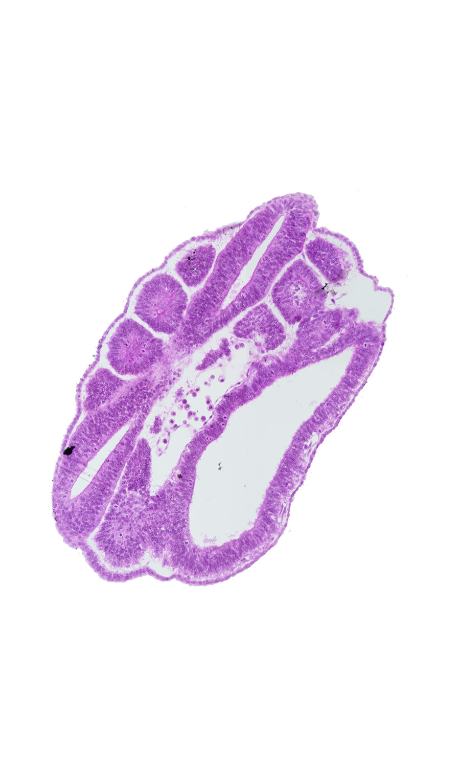 caudal edge of somite 17 (T-5), floor plate, intermediate mesenchyme, junction of aorta and left common iliac artery, neural tube, paraxial mesoderm, roof plate, somite 18 (T-6), somitocoel, sulcus limitans, ventral edge of somite 19 (T-7), ventral edge of somite 20 (T-8), ventral edge of somite 21 (T-9), ventral edge of somite 22 (T-10), ventral edge of somite 23 (T-11)