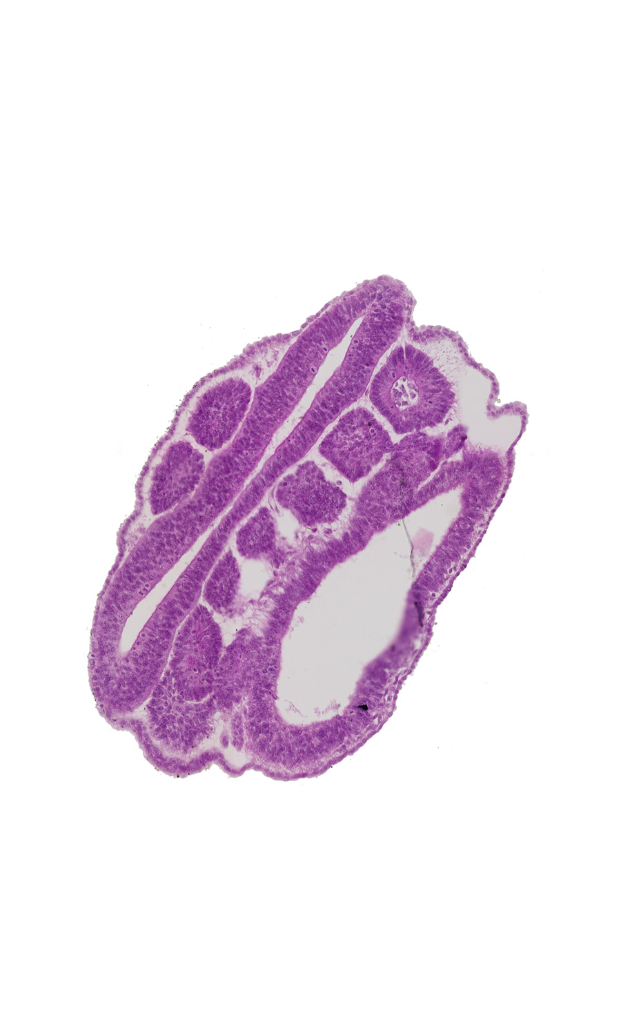 intermediate mesenchyme, lumen of neural tube, mesonephric duct, neural tube wall, peritoneal cavity, somite 18 (T-6), somitocoel