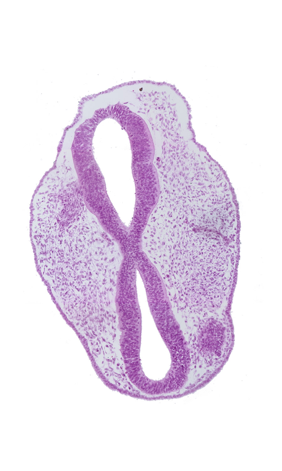 diencephalon (D2), edge of optic vesicle, floor plate of mesencephalon (M2), head mesenchyme, mesencephalon (M1), mesencoel, prosencoel (third ventricle), rhombencephalon (Rh. 2), rhombencephalon (Rh. 3), rhombencoel (fourth ventricle), roof plate, surface ectoderm, trigeminal neural crest (CN V)