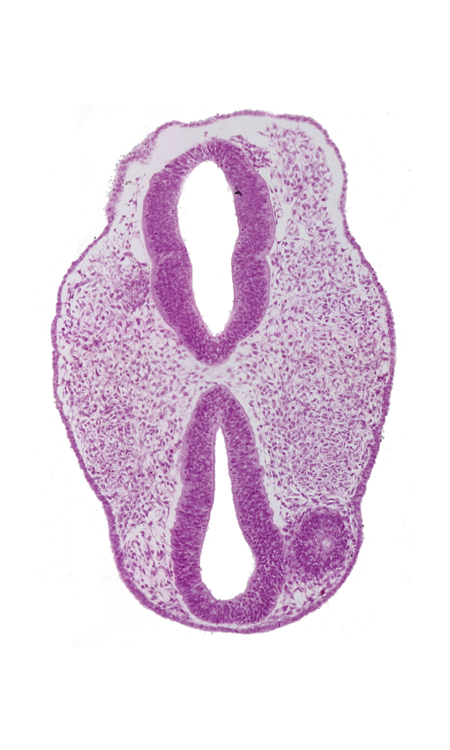 diencephalon (D1), diencephalon (D2), edge of intraretinal space (optic vesicle cavity), facio-vestibulocochlear neural crest (CN VII and CN VIII), mesencephalon (M1), mesencoel, optic neural crest (D1), optic vesicle (D1), prosencoel (third ventricle), region of mesencephalic (cephalic) flexure, rhombencephalon (Rh. 2), rhombencephalon (Rh. 3), rhombencephalon (Rh. 4), rhombencoel (fourth ventricle), surface ectoderm, vascular plexus