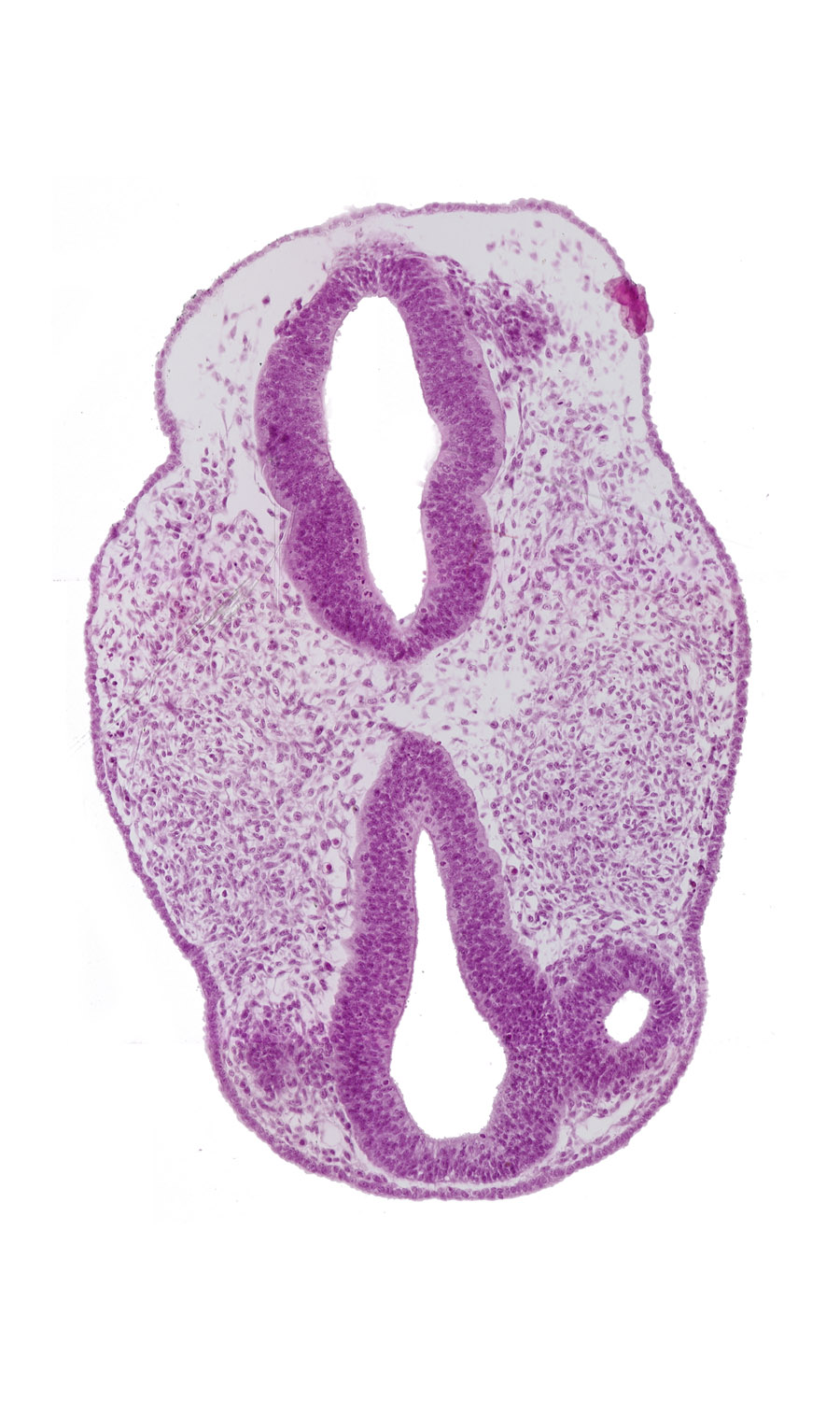 diencephalon (D1), diencephalon (D2), facio-vestibulocochlear neural crest (CN VII and CN VIII), intraretinal space (optic vesicle cavity), optic vesicle (D1), region of mesencephalic (cephalic) flexure, rhombencephalon (Rh. 2), rhombencephalon (Rh. 3), rhombencephalon (Rh. 4), surface ectoderm, venous plexus(es)