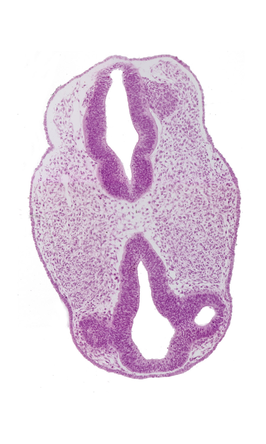 diencephalon (D1), diencephalon (D2), facio-vestibulocochlear neural crest (CN VII and CN VIII), region of mesencephalic (cephalic) flexure, rhombencephalon (Rh. 3), rhombencephalon (Rh. 4), venous plexus(es)