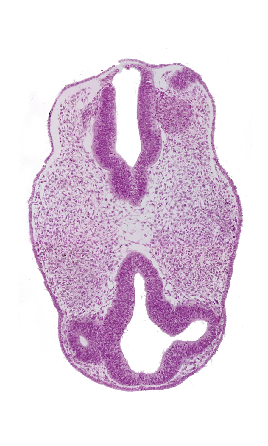cephalic edge of otic vesicle, diencephalon (D1), diencephalon (D2), facio-vestibulocochlear neural crest (CN VII and CN VIII), intraretinal space (optic vesicle cavity), presumptive optic stalk (CN II), region of mesencephalic (cephalic) flexure, rhombencephalon (Rh. 3), rhombencephalon (Rh. 4), roof plate, venous plexus(es)