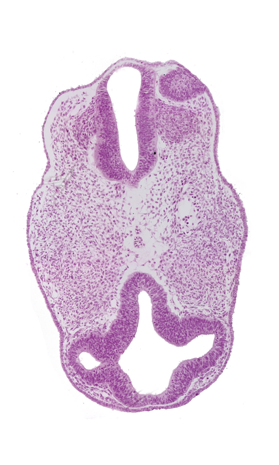cephalic edge of dorsal aorta, cephalic edge of notochord, cephalic edge of otic vesicle, communication between intraretinal space (optic vesicle cavity) and prosencoel (third ventricle), diencephalon (D1), diencephalon (D2), facio-vestibulocochlear neural crest (CN VII and CN VIII), intraretinal space (optic vesicle cavity), optic vesicle (D1), prosencoel (third ventricle), rhombencephalon (Rh. 3), rhombencephalon (Rh. 4), vascular plexus