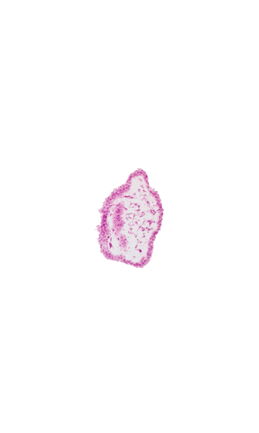 cephalic edge of mesencephalon (M2), cephalic edge of rhombencephalon (Rh. 1), head mesenchyme