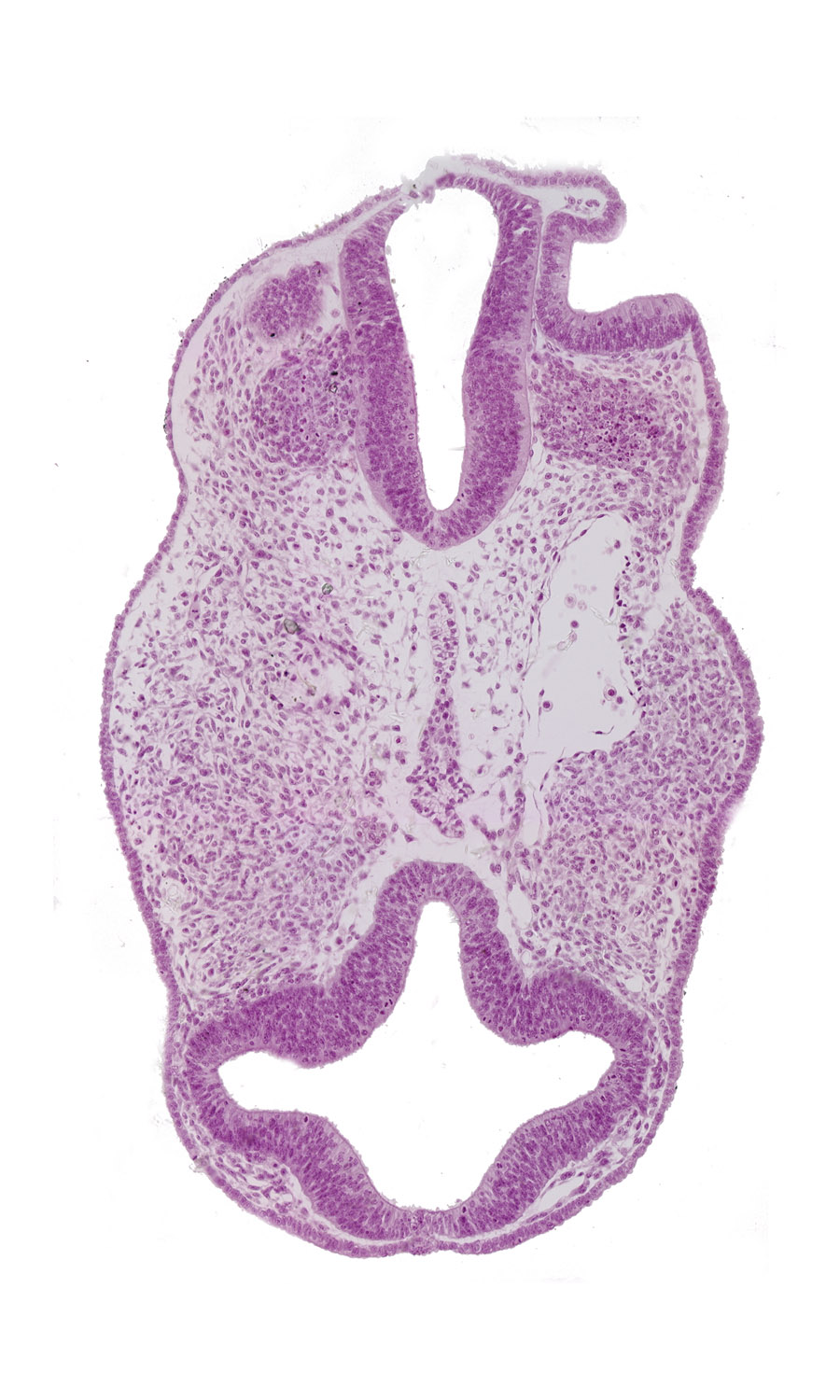 diencephalon (D1), diencephalon (D2), dorsal aorta, facio-vestibulocochlear neural crest (CN VII and CN VIII), optic vesicle (D1), otic pit, prosencoel (third ventricle), rhombencephalon (Rh. 4), surface ectoderm