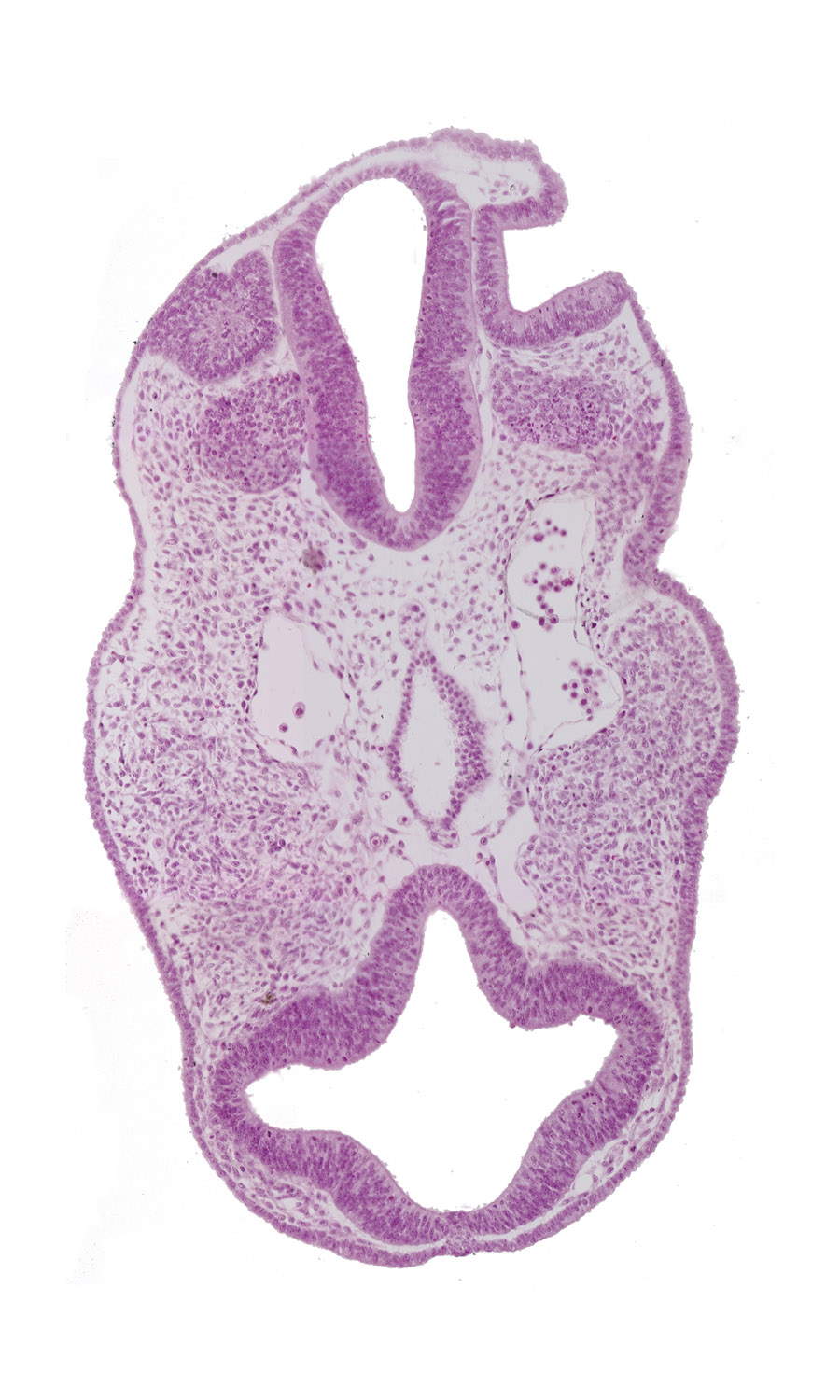 cephalic edge of pharynx lumen, cephalic tip of notochord, diencephalon (D2), dorsal aorta, epipharyngeal placode 2, facio-vestibulocochlear neural crest (CN VII and CN VIII), internal carotid artery, nasal disc (olfactory placode), neuropore site, notochord, optic vesicle (D1), otic pit, prosencoel (third ventricle), rhombencephalon (Rh. 4), rhombencephalon (Rh. 5), telencephalon medium (T)