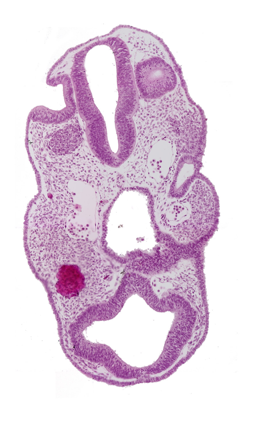 adenohypophysial pouch, caudal wall of otic vesicle, chiasmatic plate (D1), dorsal aorta, ectoderm, epipharyngeal placode 2, internal carotid artery, junction of aortic arch 1 and dorsal aorta, junction of notochord and pharyngeal wall, neuropore site, pharyngeal arch 1, pharyngeal groove 1, pharyngeal pouch 1, rhombencephalon (Rh. 4), rhombencephalon (Rh. 5)