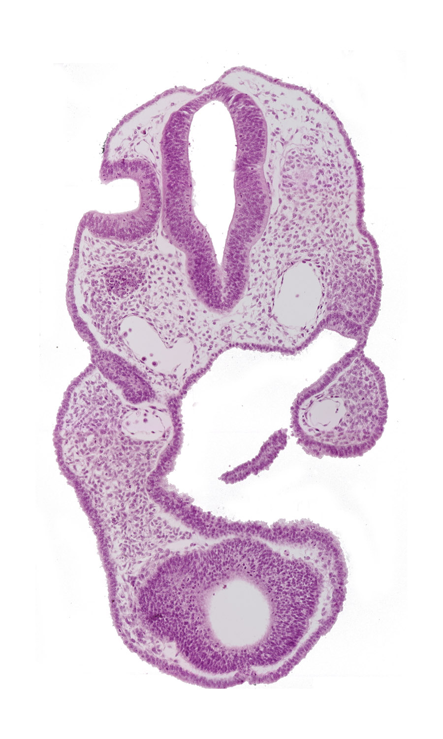 adenohypophysial pouch, aortic arch 1, caudal edge of otic vesicle, dorsal aorta, edge of optic vesicle, endoderm, neuropore site, notochord, oropharyngeal membrane, pharyngeal pouch 1, primary head vein tributary, prosencoel (third ventricle), rhombencephalon (Rh. 5), rhombencephalon (Rh. 6), telencephalon medium (T)