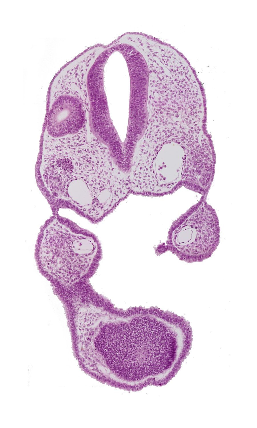 aortic arch 1, ectoderm, endoderm, left dorsal aorta, nasal disc (olfactory placode), notochord, otic vesicle, pharyngeal arch 1, pharyngeal pouch 1, pharynx, remnant of oropharyngeal membrane, rhombencephalon (Rh. 6), stomodeum, telencephalon medium (T), wall separating right dorsal aorta