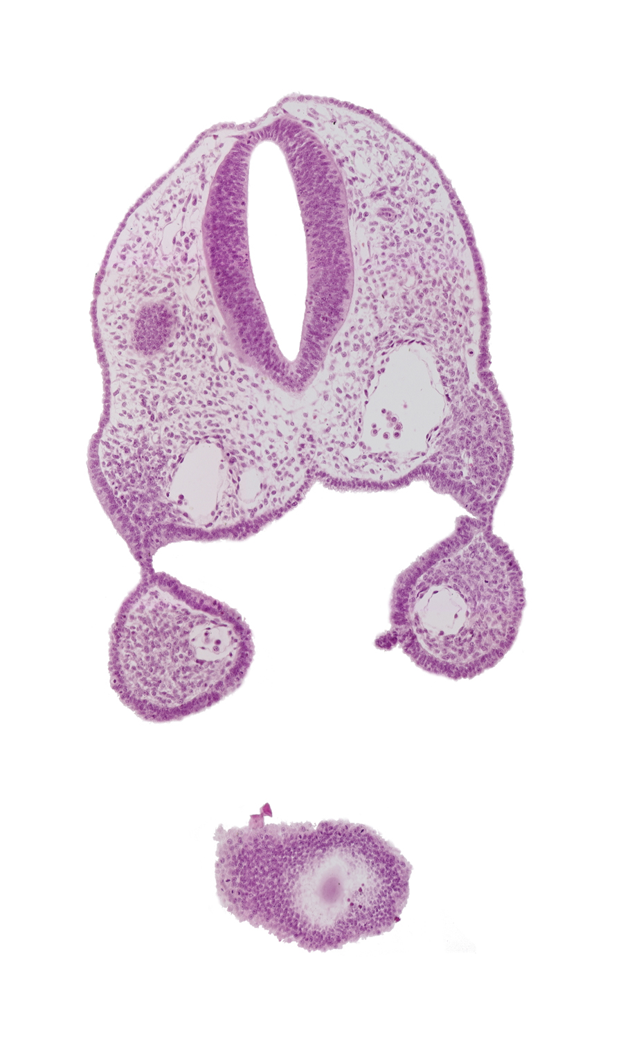 aortic arch 1, caudal edge of otic vesicle, cephalic edge of telencephalon medium (T), cephalic part of head, dorsal aorta, ectoderm, glossopharyngeal neural crest (CN IX), mesenchyme, pharyngeal membrane 1, pharynx, remnant of oropharyngeal membrane, rhombencephalon (Rh. 5), rhombencephalon (Rh. 6), stomodeum