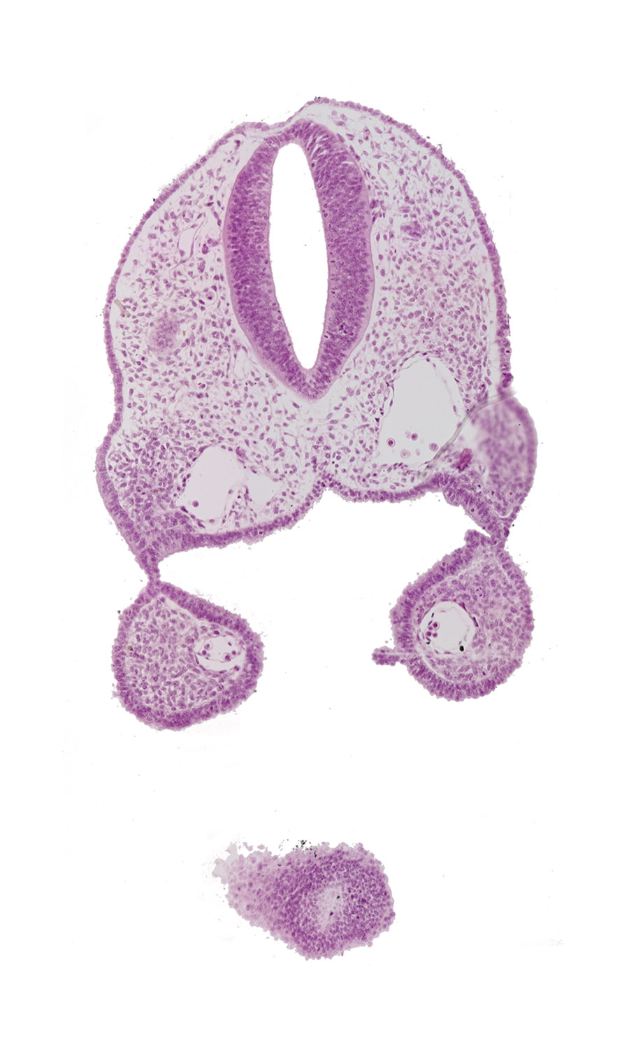 aortic arch 1, cephalic edge of head, dorsal aorta, ectoderm, endoderm, glossopharyngeal neural crest (CN IX), pharyngeal membrane 1, pharynx, remnant of oropharyngeal membrane, rhombencephalon (Rh. 5), rhombencephalon (Rh. 6), stomodeum