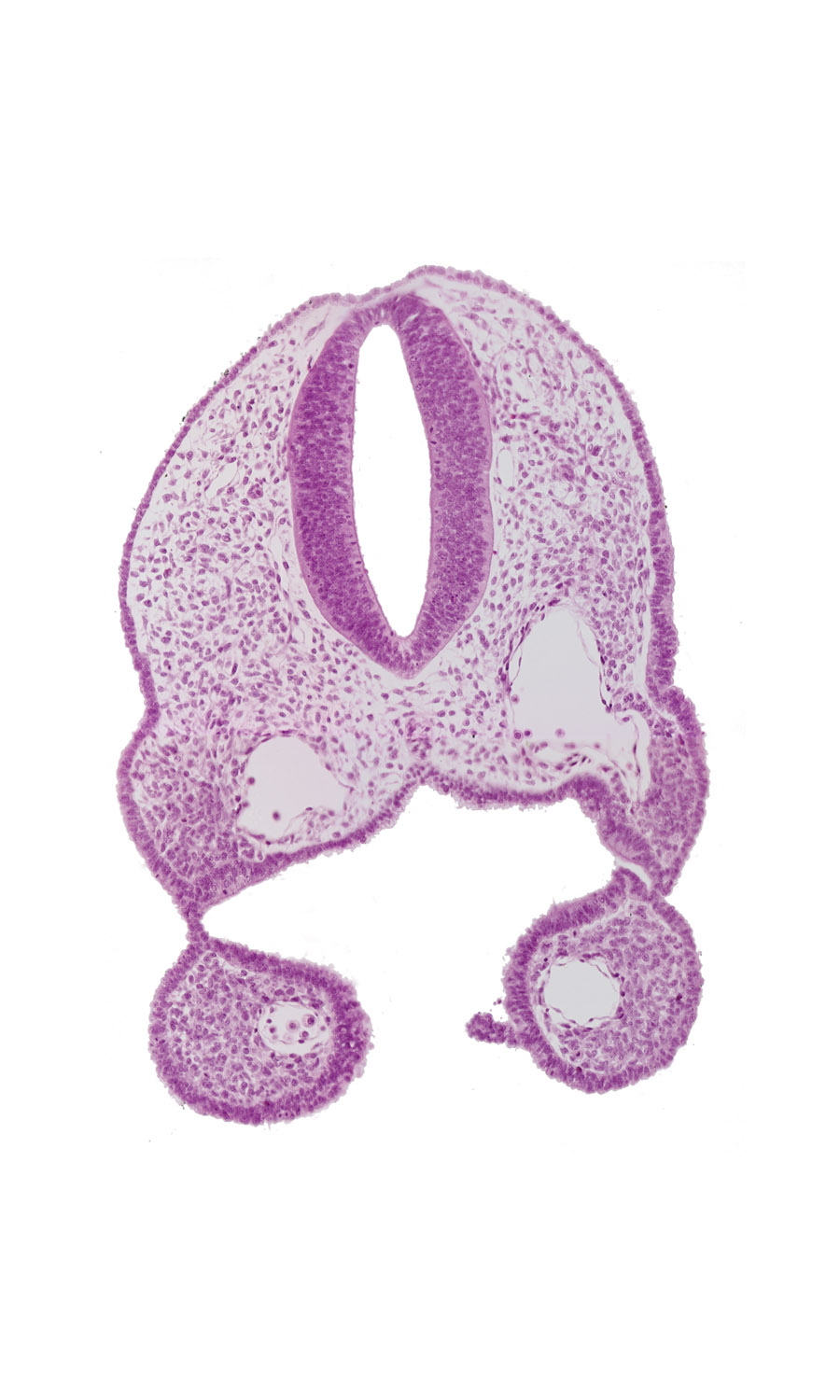 aortic arch 1, dorsal aorta, ectoderm, ectodermal ring, endoderm, glossopharyngeal neural crest (CN IX), head mesenchyme, junction of aortic arch 2 and dorsal aorta, mesenchyme, notochord, pharyngeal arch 1, pharyngeal groove 1, pharyngeal membrane 1, pharyngeal pouch 1, pharynx, primary head vein, remnant of oropharyngeal membrane, rhombencephalon (Rh. 6)