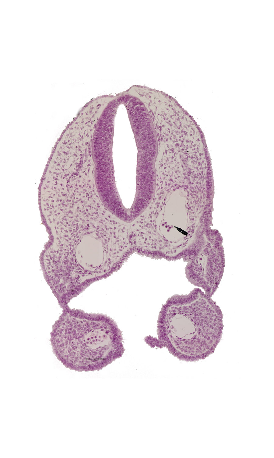 aortic arch 2, dorsal aorta, ectodermal ring, glossopharyngeal neural crest (CN IX), notochord, pharyngeal arch 1, pharyngeal arch 2, pharyngeal groove 1, pharyngeal groove 2, pharyngeal membrane 1, pharynx, remnant of oropharyngeal membrane, rhombencephalon (Rh. 6), rhombencoel (fourth ventricle), stomodeum