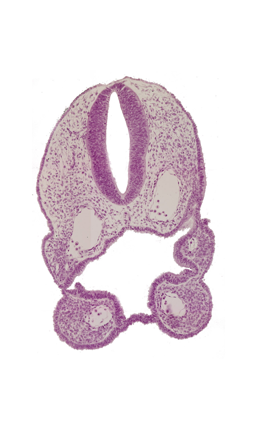 aortic arch 1, aortic arch 2, caudal part of oropharyngeal membrane, ectoderm, ectodermal ring, endoderm, floor plate, junction of aortic arch 2 and dorsal aorta, notochord, pharyngeal groove 1, pharyngeal membrane 2, pharyngeal pouch 1, pharyngeal pouch 2, pharynx, rhombencephalon (Rh. 6), rhombencephalon (Rh. 7), roof plate, stomodeum