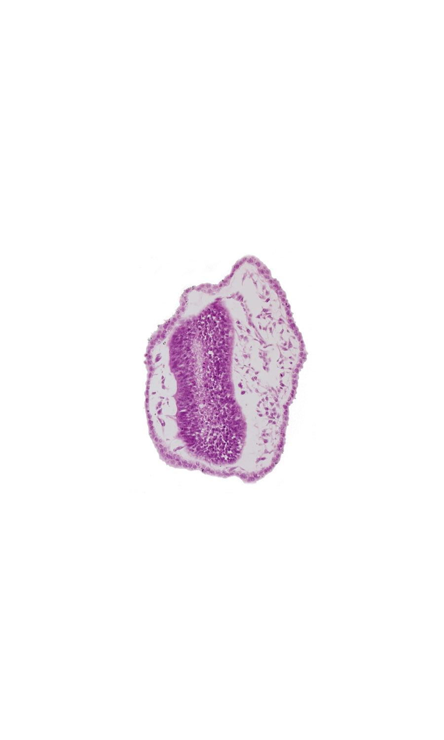 edge of neural tube lumen, head mesenchyme, mesencephalon (M2), rhombencephalon (Rh. 1), surface ectoderm