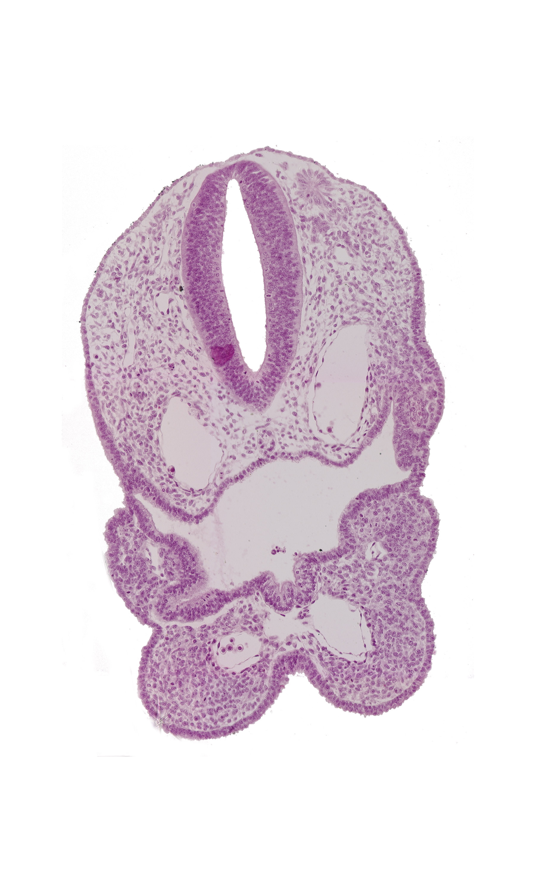 aortic arch 1, aortic arch 2, cervical sinus, dermatomyotome 1 (O-1), ectodermal ring, median mandibular groove, perinotochordal lamina, pharyngeal arch 1, pharyngeal arch 2, pharyngeal arch 3, pharyngeal groove 3, pharyngeal pouch 2, pharyngeal pouch 3, pharynx, rhombencephalon (Rh. D), thyroid diverticulum