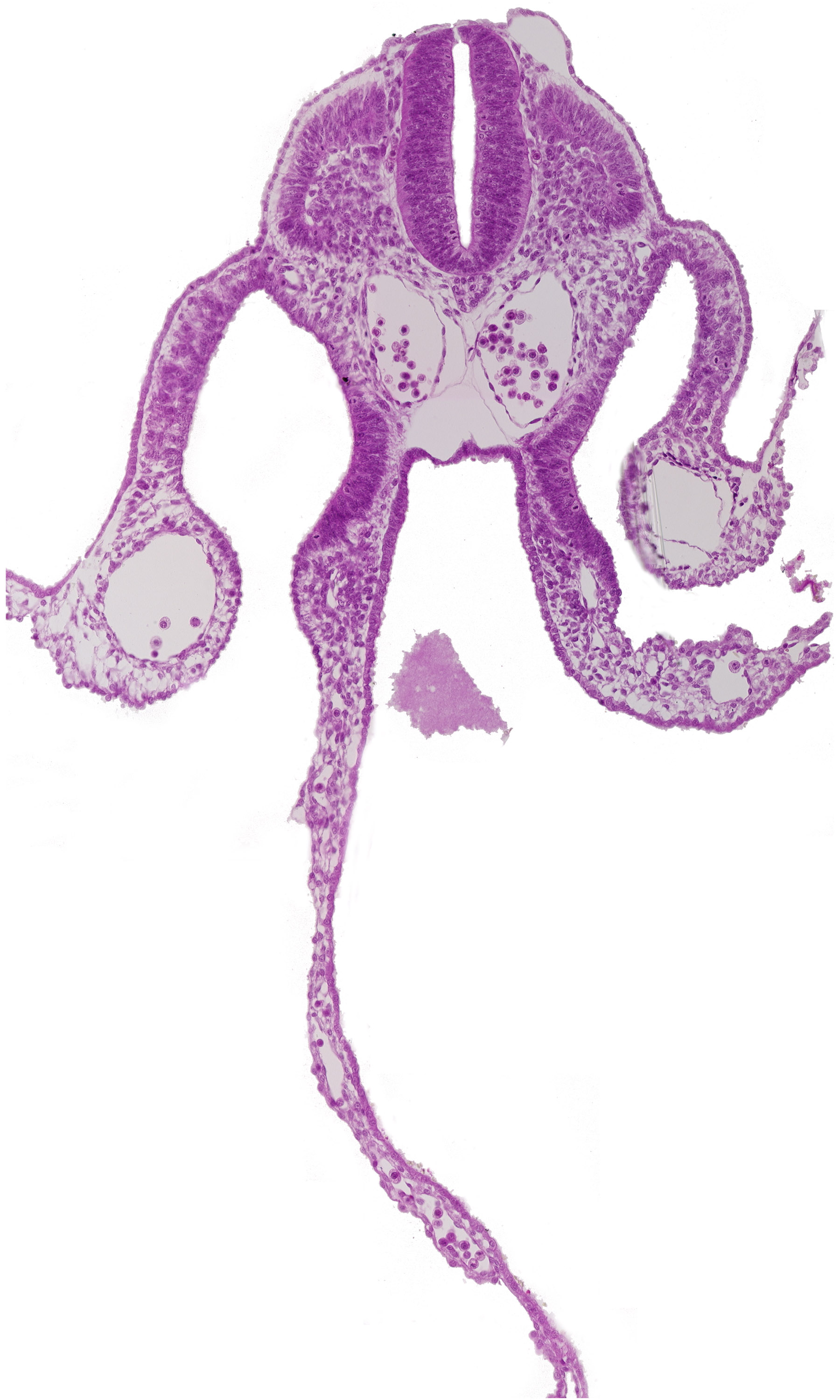 amniotic cavity, dermatomyotome 8 (C-4), dorsal aorta, dorsal intersegmental artery, endoderm, extra-embryonic coelom, notochord, peritoneal cavity, sclerotome, somatopleuric mesoderm, splanchnopleuric mesoderm, umbilical vesicle cavity